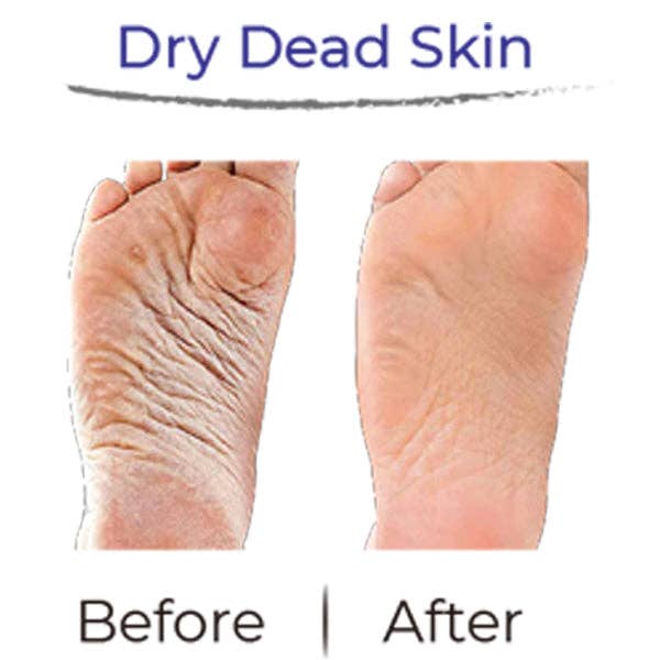 RevivaFoot Exfoliating Foot Peel Masks Treatments Breezy